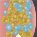 Fat Cells Closeup 3