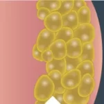 Fat Cells Closeup 4